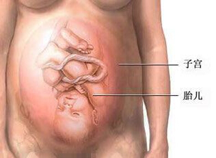剖腹产过程图1-2