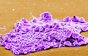 乳腺癌细胞图谱