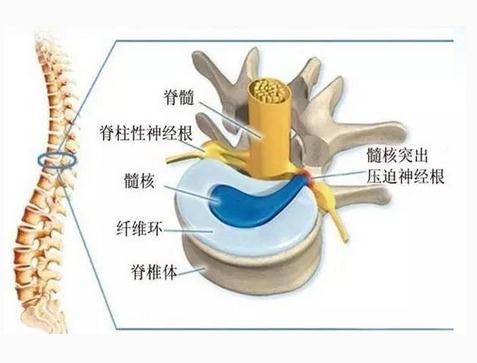 椎间盘解剖图
