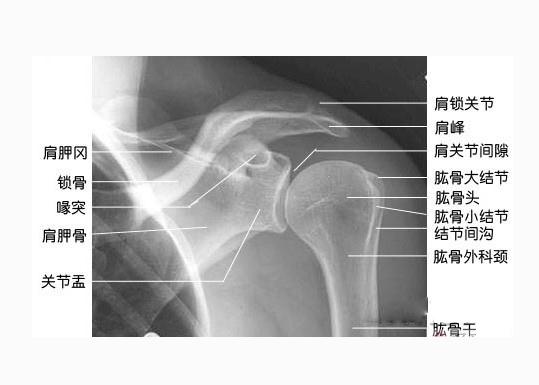 [运动系统]肩  关节X线像