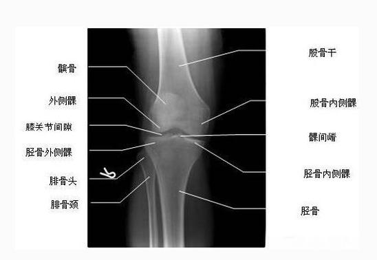 [运动系统]膝关节X线像