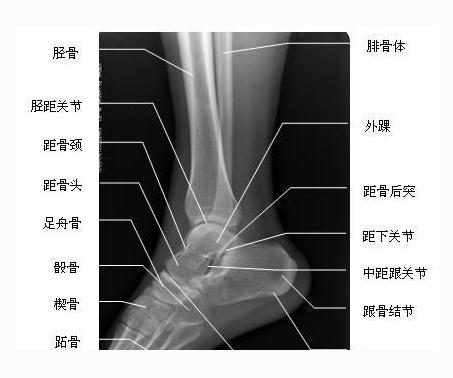 [运动系统]踝和足的X线像