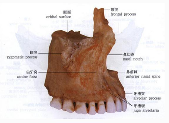 上颌骨(前面观)