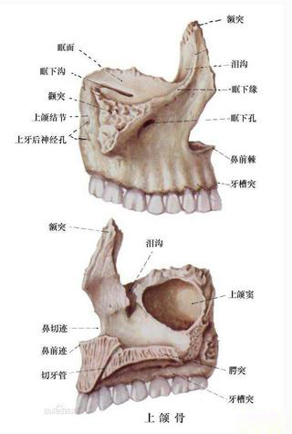 上颌骨