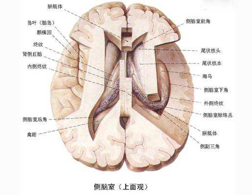 侧脑室（上面观）