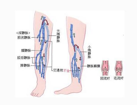 小腿静脉