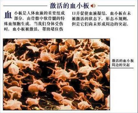 激活的血小板