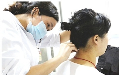 图为颈椎病人正在接受针灸治疗