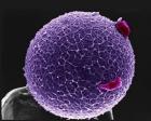 带有冠细胞的人类卵子这张彩色图片上的紫色人类卵子坐落在一个柱状物上。它上面包裹一层透明带状物——醣蛋白，这种物质既具有保护卵细胞的作用，又能诱捕和限制精子。两个红色冠细胞粘贴在透明带状物上。